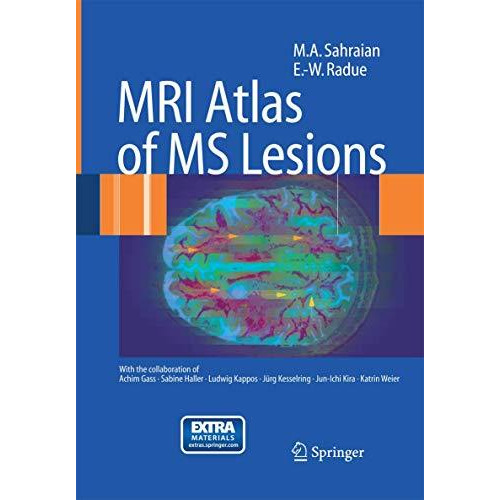 MRI Atlas of MS Lesions [Paperback]