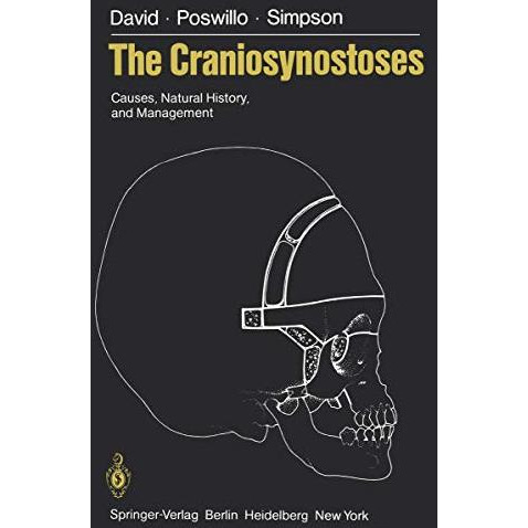 The Craniosynostoses: Causes, Natural History, and Management [Paperback]