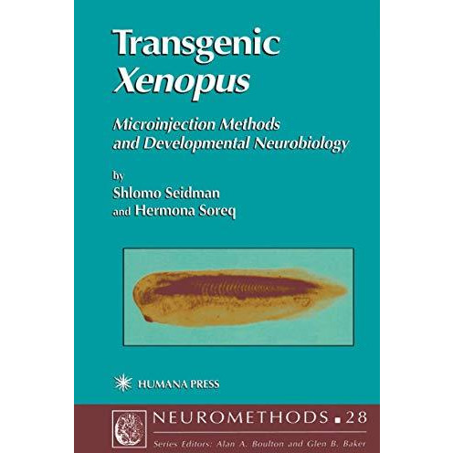 Transgenic Xenopus: Microinjection Methods and Developmental Neurobiology [Hardcover]