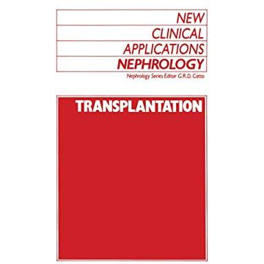 Transplantation [Paperback]