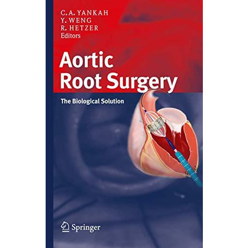 Aortic Root Surgery: The Biological Solution [Paperback]