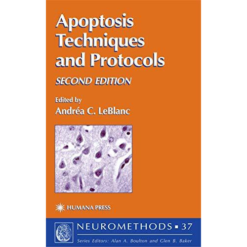 Apoptosis Techniques and Protocols [Paperback]