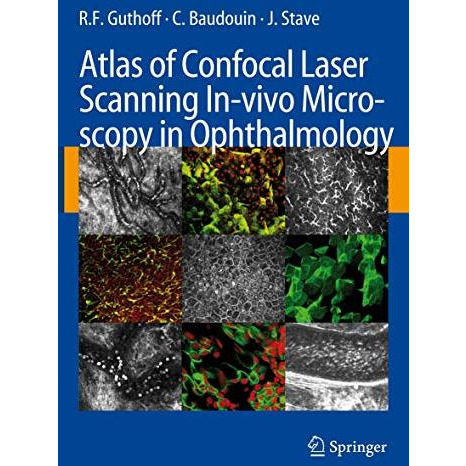 Atlas of Confocal Laser Scanning In-vivo Microscopy in Ophthalmology [Hardcover]