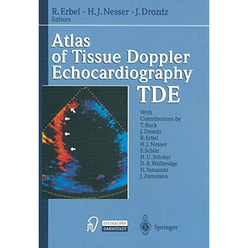 Atlas of Tissue Doppler Echocardiography  TDE [Paperback]