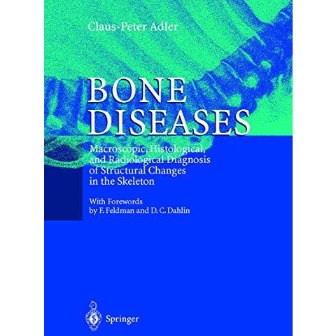 Bone Diseases: Macroscopic, Histological, and Radiological Diagnosis of Structur [Hardcover]