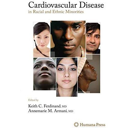 Cardiovascular Disease in Racial and Ethnic Minorities [Hardcover]