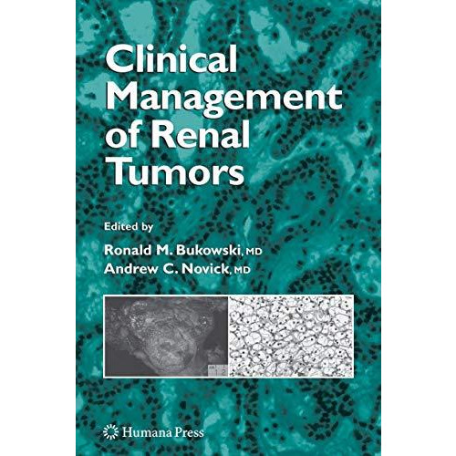 Clinical Management of Renal Tumors [Hardcover]