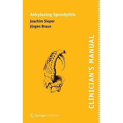 Clinician's Manual on Ankylosing Spondylitis [Paperback]