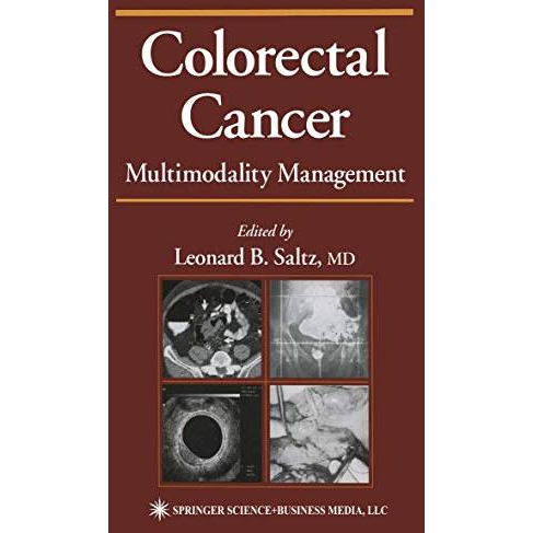 Colorectal Cancer: Multimodality Management [Paperback]