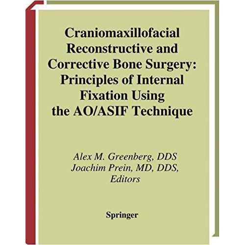 Craniomaxillofacial Reconstructive and Corrective Bone Surgery: Principles of In [Paperback]