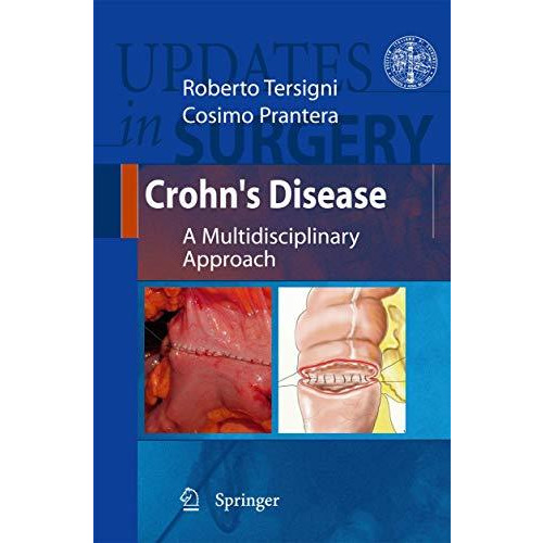 Crohn's Disease: A Multidisciplinary Approach [Hardcover]