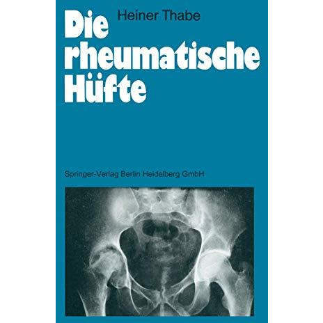 Die rheumatische H?fte [Paperback]