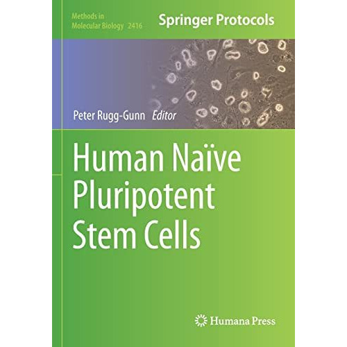 Human Na?ve Pluripotent Stem Cells [Paperback]