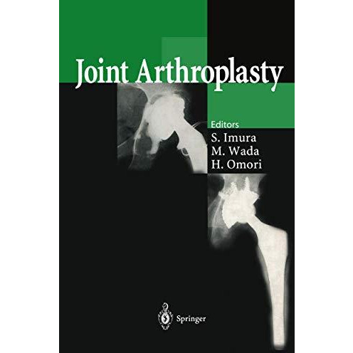 Joint Arthroplasty [Hardcover]