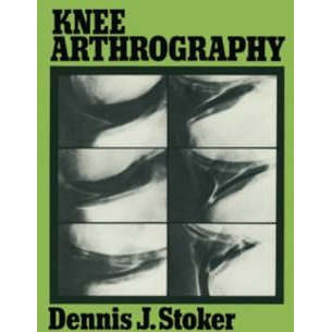 Knee Arthrography [Paperback]