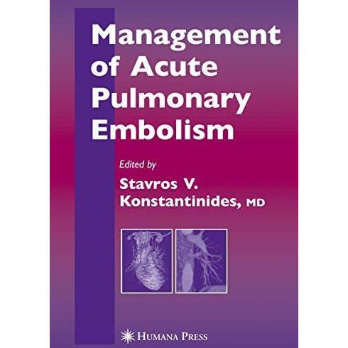 Management of Acute Pulmonary Embolism [Paperback]