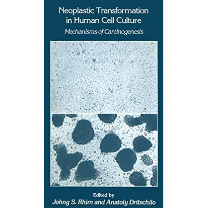 Neoplastic Transformation in Human Cell Culture: Mechanisms of Carcinogenesis [Hardcover]