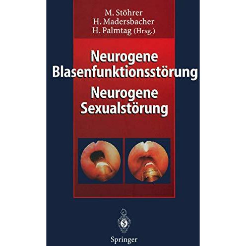 Neurogene Blasenfunktionsst?rung Neurogene Sexualst?rung [Paperback]