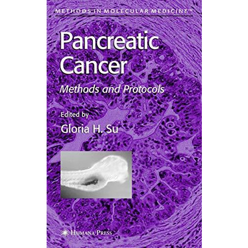 Pancreatic Cancer: Methods and Protocols [Hardcover]