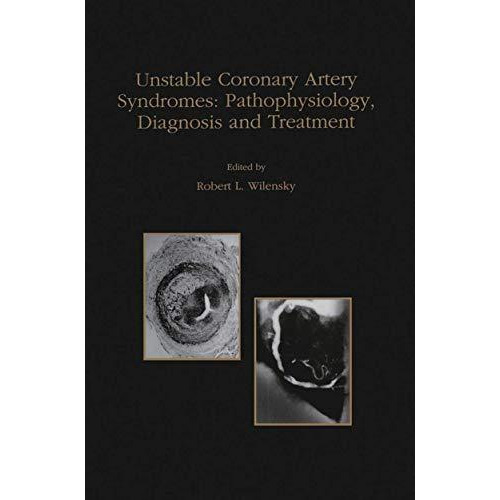 Unstable Coronary Artery Syndromes Pathophysiology, Diagnosis and Treatment [Paperback]