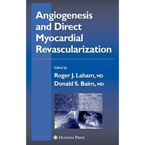 Angiogenesis and Direct Myocardial Revascularization [Hardcover]