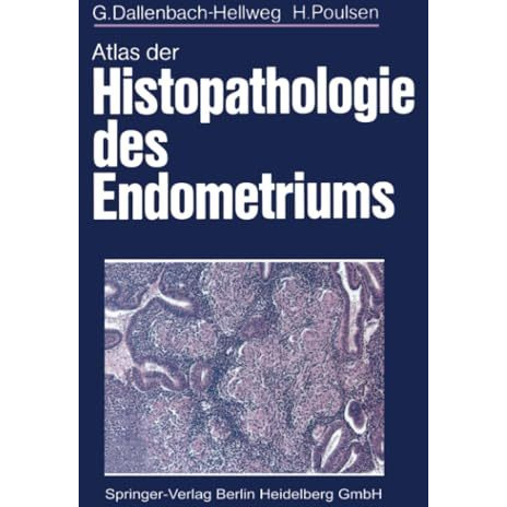 Atlas der Histopathologie des Endometriums [Paperback]