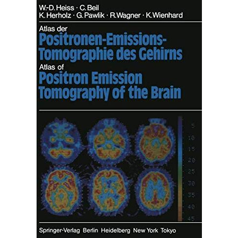 Atlas der Positronen-Emissions-Tomographie des Gehirns / Atlas of Positron Emiss [Paperback]