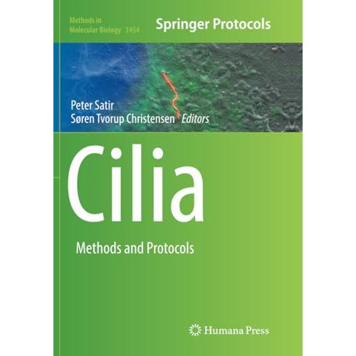 Cilia: Methods and Protocols [Paperback]