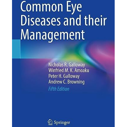 Common Eye Diseases and their Management [Paperback]