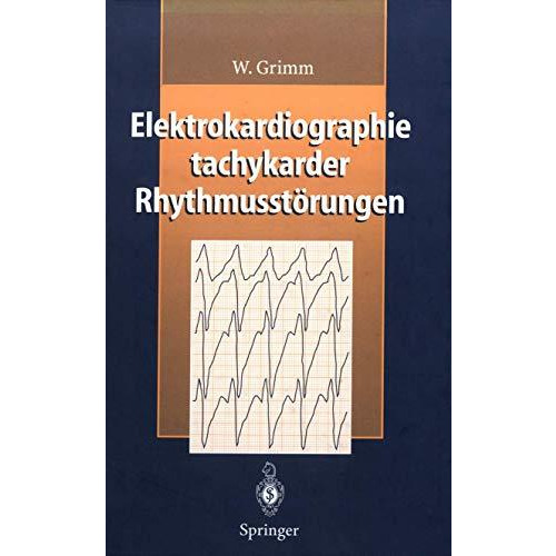 Elektrokardiographie tachykarder Rhythmusst?rungen [Paperback]