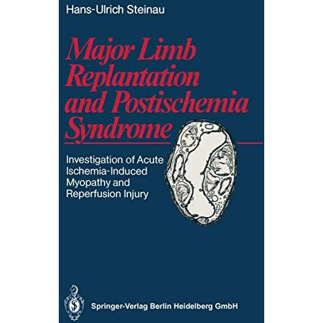 Major Limb Replantation and Postischemia Syndrome: Investigation of Acute Ischem [Paperback]