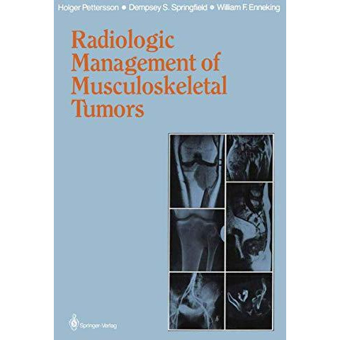 Radiologic Management of Musculoskeletal Tumors [Paperback]