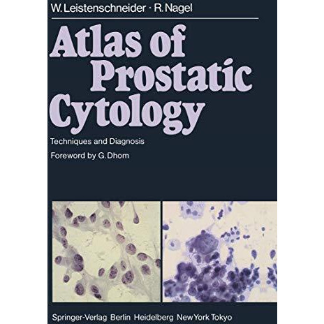 Atlas of Prostatic Cytology: Techniques and Diagnosis [Paperback]