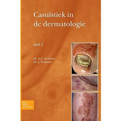 Casu?stiek in de dermatologie - deel I [Paperback]