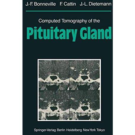 Computed Tomography of the Pituitary Gland: With a Chapter on Magnetic Resonance [Paperback]