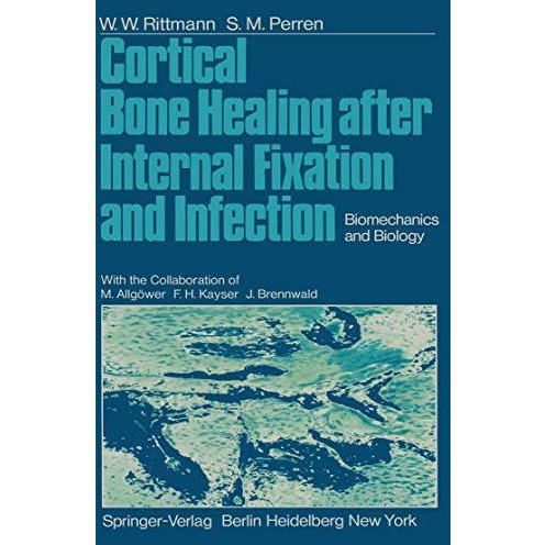 Cortical Bone Healing after Internal Fixation and Infection: Biomechanics and Bi [Paperback]