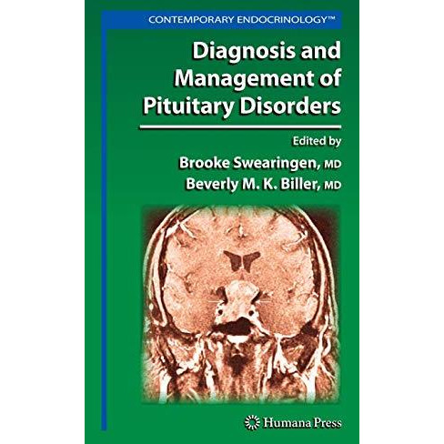 Diagnosis and Management of Pituitary Disorders [Paperback]