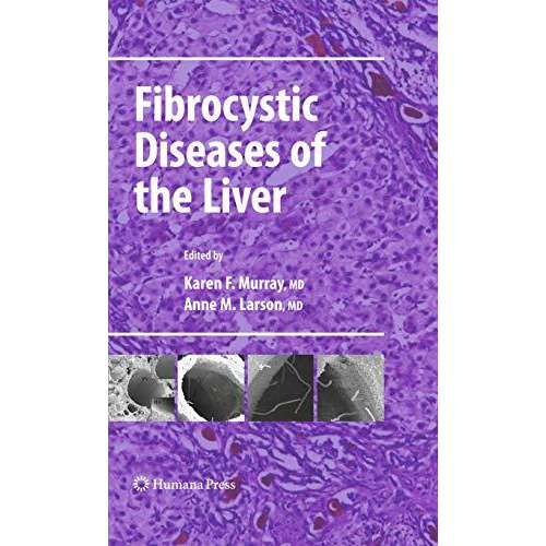 Fibrocystic Diseases of the Liver [Hardcover]