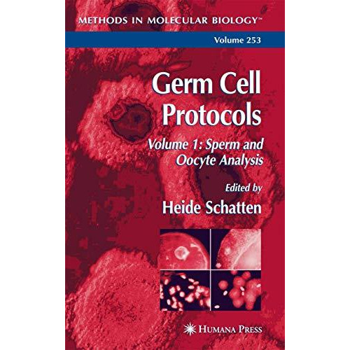 Germ Cell Protocols: Volume 1: Sperm and Oocyte Analysis [Hardcover]