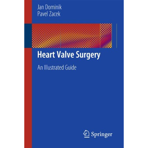 Heart Valve Surgery: An Illustrated Guide [Paperback]