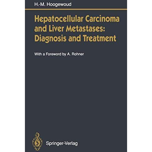 Hepatocellular Carcinoma and Liver Metastases: Diagnosis and Treatment [Paperback]