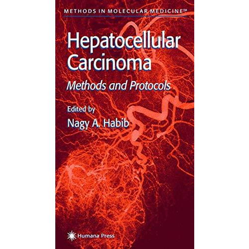 Hepatocellular Carcinoma: Methods and Protocols [Paperback]