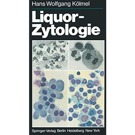 Liquor-Zytologie [Paperback]