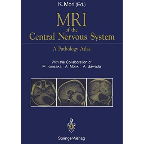 MRI of the Central Nervous System: A Pathology Atlas [Paperback]