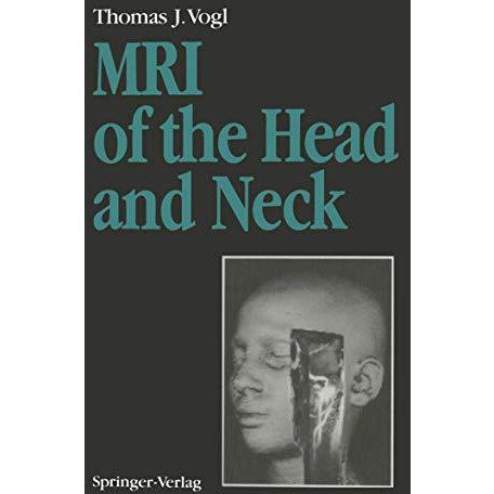 MRI of the Head and Neck: Functional Anatomy  Clinical Findings  Pathology  I [Paperback]