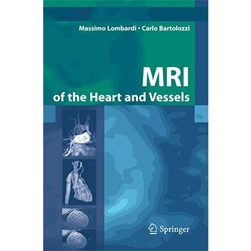 MRI of the Heart and Vessels [Hardcover]