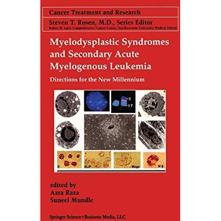 Myelodysplastic Syndromes & Secondary Acute Myelogenous Leukemia: Directions [Paperback]