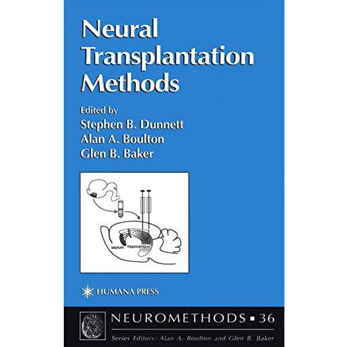 Neural Transplantation Methods [Paperback]