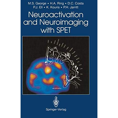 Neuroactivation and Neuroimaging with SPET [Paperback]