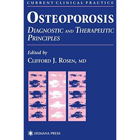 Osteoporosis: Diagnostic and Therapeutic Principles [Hardcover]